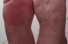 Piccoli Piedi Paffutelli